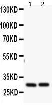 Anti-Bcl2A1 antibody, PA2102, Western blotting
All lanes: Anti Bcl2A1(PA2102) at 0.5ug/ml
Lane 1: HELA Whole Cell Lysate at 40ug
Lane 2: JURKAT Whole Cell Lysate at 40ug
Predicted bind size: 30KD
Observed bind size: 30KD
