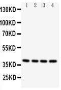 Anti-Caspase-12 antibody, PA2103, Western blotting
All lanes: Anti Caspase-12 (PA2103) at 0.5ug/ml

Lane 1: PANC Whole Cell Lysate at 40ug

Lane 2: SMMC Whole Cell Lysate at 40ug

Lane 3: A549 Whole Cell Lysate at 40ug

Lane 4: HELA Whole Cell Lysate at 40ug

Predicted bind size: 39KD

Observed bind size: 39KD