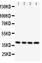Anti-Caspase-12 antibody, PA2103, Western blotting
All lanes: Anti Caspase-12 (PA2103) at 0.5ug/ml

Lane 1: PANC Whole Cell Lysate at 40ug

Lane 2: SMMC Whole Cell Lysate at 40ug

Lane 3: A549 Whole Cell Lysate at 40ug

Lane 4: HELA Whole Cell Lysate at 40ug

Predicted bind size: 39KD

Observed bind size: 39KD