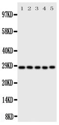 Anti-Caspase-14 antibody, PA2104, Western blotting
All lanes: Anti Caspase-14 (PA2104) at 0.5ug/ml

Lane 1: Rat Brain Tissue Lysate at 50ug

Lane 2: Rat Liver Tissue Lysate at 50ug

Lane 3: Rat Spleen Tissue Lysate at 50ug

Lane 4: A431 Whole Cell Lysate at 40ug

Lane 5: NIH3T3 Whole Cell Lysate at 40ug

Predicted bind size: 28KD

Observed bind size: 28KD