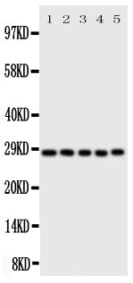 Anti-Caspase-14 antibody, PA2104, Western blotting
All lanes: Anti Caspase-14 (PA2104) at 0.5ug/ml

Lane 1: Rat Brain Tissue Lysate at 50ug

Lane 2: Rat Liver Tissue Lysate at 50ug

Lane 3: Rat Spleen Tissue Lysate at 50ug

Lane 4: A431 Whole Cell Lysate at 40ug

Lane 5: NIH3T3 Whole Cell Lysate at 40ug

Predicted bind size: 28KD

Observed bind size: 28KD