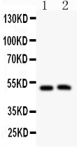 Anti-MIP antibody, PA2110, Western blotting
All lanes: Anti MIP (PA2110) at 0.5ug/ml
Lane 1: Mouse Spleen Tissue Lysate at 50ug
Lane 2: Mouse Intestine Tissue Lysate at 50ug
Predicted bind size: 28KD
Observed bind size: 50KD