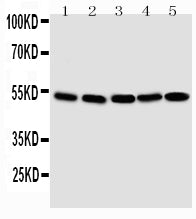 Anti-Smad1 antibody, PA2114, Western blotting
Lane 1: SMMC Cell Lysate
Lane 2: K562 Cell Lysate
Lane 3: HT1080 Cell Lysate
Lane 4: HELA Cell Lysate
Lane 5: JURKAT Cell Lysate