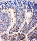 Anti-SMAD5 antibody, PA2115, IHC(P)
IHC(P): Rat Intestine Tissue