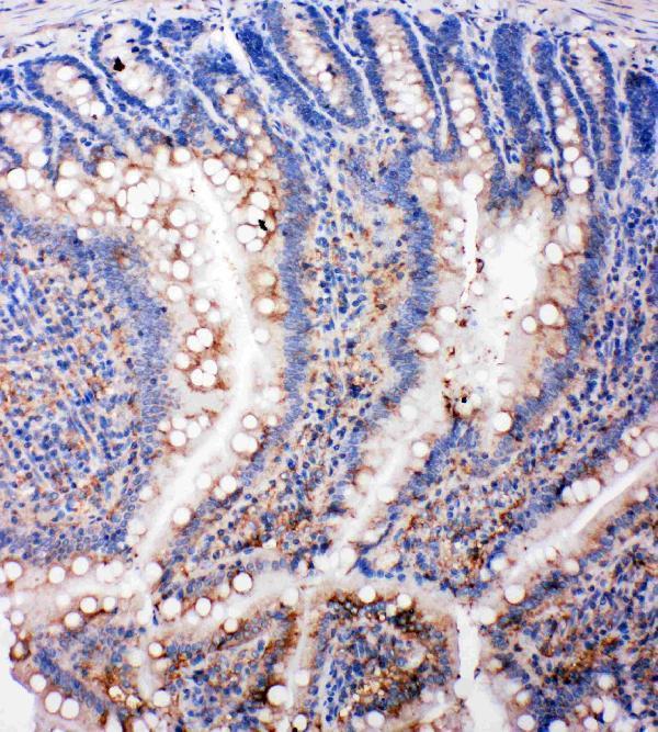 Anti-SMAD5 antibody, PA2115, IHC(P)
IHC(P): Rat Intestine Tissue