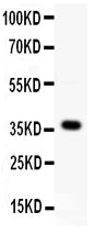 Anti-WNT4 antibody, PA2121, Western blotting
All lanes: Anti WNT4 (PA2121) at 0.5ug/ml
WB: MCF-7 Whole Cell Lysate at 40ug
Predicted bind size: 37KD
Observed bind size: 37KD