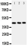 Anti-CCR9 antibody, PA2122, Western blotting
All lanes: Anti CCR9 (PA2122) at 0.5ug/ml

Lane 1: JURKAT Whole Cell Lysate at 40ug

Lane 2: HELA Whole Cell Lysate at 40ug

Lane 3: SMMC Whole Cell Lysate at 40ug

Predicted bind size: 42KD

Observed bind size: 42KD