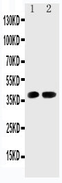Anti-Cdk6 antibody, PA2125-2, Western blotting
Lane 1: Rat Testis Tissue Lysate
Lane 2: Rat Lung Tissue Lysate