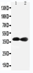 Anti-Cdk7 antibody, PA2126-1, Western blotting
Lane 1: Rat Testis Tissue Lysate
Lane 2: Rat Ovary Tissue Lysate