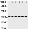 Anti-Cdk7 antibody, PA2126-2, Western blotting
All lanes: Anti Cdk7 (PA2126-2) at 0.5ug/ml

Lane 1: Rat Testis Tissue Lysate at 50ug

Lane 2: Rat Ovary Tissue Lysate at 50ug

Lane 3: HELA Whole Cell Lysate at 40ug

Lane 4: MCF-7 Whole Cell Lysate at 40ug

Lane 5: A549 Whole Cell Lysate at 40ug

Lane 6: COLO320 Whole Cell Lysate at 40ug

Predicted bind size: 39KD

Observed bind size: 39KD