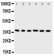 Anti-Cdk7 antibody, PA2126-2, Western blotting
All lanes: Anti Cdk7 (PA2126-2) at 0.5ug/ml

Lane 1: Rat Testis Tissue Lysate at 50ug

Lane 2: Rat Ovary Tissue Lysate at 50ug

Lane 3: HELA Whole Cell Lysate at 40ug

Lane 4: MCF-7 Whole Cell Lysate at 40ug

Lane 5: A549 Whole Cell Lysate at 40ug

Lane 6: COLO320 Whole Cell Lysate at 40ug

Predicted bind size: 39KD

Observed bind size: 39KD