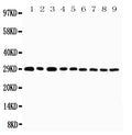 Anti-CD134/OX40 antibody, PA2136-1, Western blotting
Lane 1: U87 Cell Lysate
Lane 2: HELA Cell Lysate
Lane 3: HT1080 Cell Lysate
Lane 4: JURKAT Cell Lysate
Lane 5: COLO320 Cell Lysate
Lane 6: MCF-7 Cell Lysate
Lane 7: SHC Cell Lysate
Lane 8: COLO320 Cell Lysate

Lane 9: SGC Cell Lysate