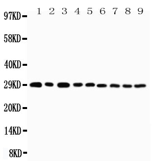 Anti-CD134/OX40 antibody, PA2136-1, Western blotting
Lane 1: U87 Cell Lysate
Lane 2: HELA Cell Lysate
Lane 3: HT1080 Cell Lysate
Lane 4: JURKAT Cell Lysate
Lane 5: COLO320 Cell Lysate
Lane 6: MCF-7 Cell Lysate
Lane 7: SHC Cell Lysate
Lane 8: COLO320 Cell Lysate

Lane 9: SGC Cell Lysate