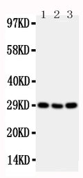 Anti-CD134/OX40 antibody, PA2136-2, Western blotting
Lane 1: Mouse Brain Tissue Lysate
Lane 2: Mouse Spleen Tissue Lysate
Lane 3: Mouse Liver Tissue Lysate