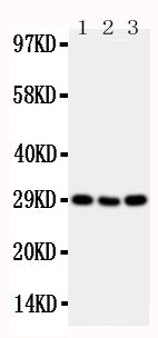 Anti-CD134/OX40 antibody, PA2136-2, Western blotting
Lane 1: Mouse Brain Tissue Lysate
Lane 2: Mouse Spleen Tissue Lysate
Lane 3: Mouse Liver Tissue Lysate