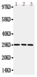 Anti-CD134/OX40 antibody, PA2136-3, Western blotting
All lanes: Anti CD134/OX40 (PA2136-3) at 0.5ug/ml
Lane 1: Rat Brain Tissue Lysate at 50ug
Lane 2: Rat Liver Tissue Lysate at 50ug
Lane 3: Rat Kidney Tissue Lysate at 50ug
Predicted bind size: 29KD
Observed bind size: 29KD