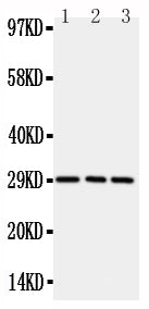 Anti-CD134/OX40 antibody, PA2136-3, Western blotting
All lanes: Anti CD134/OX40 (PA2136-3) at 0.5ug/ml
Lane 1: Rat Brain Tissue Lysate at 50ug
Lane 2: Rat Liver Tissue Lysate at 50ug
Lane 3: Rat Kidney Tissue Lysate at 50ug
Predicted bind size: 29KD
Observed bind size: 29KD