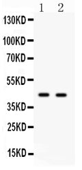 Anti-Cdc37 antibody, PA2139, Western blotting
All lanes: Anti Cdc37(PA2139) at 0.5ug/ml
Lane 1: JURKAT Whole Cell Lysate at 40ug
Lane 2: 293T Whole Cell Lysate at 40ug
Predicted bind size: 44KD
Observed bind size: 44KD