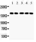 Anti-COL2A1 antibody, PA2141, Western blotting
All lanes: Anti COL2A1 (PA2141) at 0.5ug/ml
Lane 1: COLO320 Whole Cell Lysate at 40ug
Lane 2: HELA Whole Cell Lysate at 40ug
Lane 3: MCF-7Whole Cell Lysate at 40ug
Lane 4: A549 Whole Cell Lysate at 40ug
Lane 5: JURKAT Whole Cell Lysate at 40ug
Predicted bind size: 134 KD
Observed bind size: 170KD