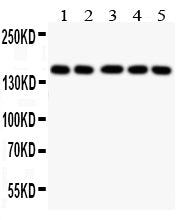 Anti-COL2A1 antibody, PA2141, Western blotting
All lanes: Anti COL2A1 (PA2141) at 0.5ug/ml
Lane 1: COLO320 Whole Cell Lysate at 40ug
Lane 2: HELA Whole Cell Lysate at 40ug
Lane 3: MCF-7Whole Cell Lysate at 40ug
Lane 4: A549 Whole Cell Lysate at 40ug
Lane 5: JURKAT Whole Cell Lysate at 40ug
Predicted bind size: 134 KD
Observed bind size: 170KD
