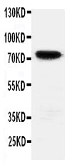 Anti-HIF3 antibody, PA2145, Western blotting
WB: Rat Brain Tissue Lysate