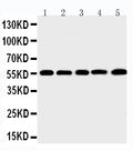 Anti-MMP12 antibody, PA2146, Western blotting
Lane 1: SMMC Cell Lysate
Lane 2: HEPA Cell Lysate
Lane 3: HELA Cell Lysate
Lane 4: K562 Cell Lysate
Lane 5: MCF-7 Cell Lysate