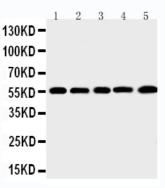 Anti-MMP12 antibody, PA2146, Western blotting
Lane 1: SMMC Cell Lysate
Lane 2: HEPA Cell Lysate
Lane 3: HELA Cell Lysate
Lane 4: K562 Cell Lysate
Lane 5: MCF-7 Cell Lysate