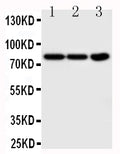 Anti-TrkA antibody, PA2149-1, Western blotting
Lane 1: COLO320 Cell Lysate
Lane 2: HT1080 Cell Lysate
Lane 3: U87 Cell Lysate