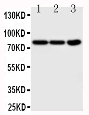 Anti-TrkA antibody, PA2149-1, Western blotting
Lane 1: COLO320 Cell Lysate
Lane 2: HT1080 Cell Lysate
Lane 3: U87 Cell Lysate