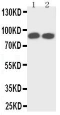 Anti-TrkA antibody, PA2149-2, Western blotting
Lane 1: Rat Brain Tissue Lysate
Lane 2: Mouse Brain Tissue Lysate