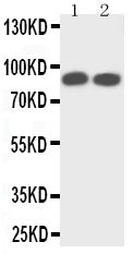 Anti-TrkA antibody, PA2149-2, Western blotting
Lane 1: Rat Brain Tissue Lysate
Lane 2: Mouse Brain Tissue Lysate