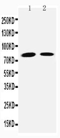 Anti-TGM2 antibody, PA2153, Western blotting
Lane 1: JURKAT Cell Lysate
Lane 2: HELA Cell Lysate