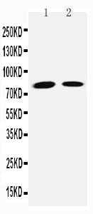Anti-TGM2 antibody, PA2153, Western blotting
Lane 1: JURKAT Cell Lysate
Lane 2: HELA Cell Lysate