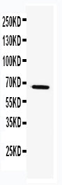 Anti-TRAF5 antibody, PA2154, Western blotting
WB: k562 Cell Lysate