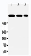 Anti-Laminin 2 alpha antibody, PA2160, Western blotting
Lane 1: HELA Cell Lysate
Lane 2: A549 Cell Lysate
Lane 3: PANC Cell Lysate