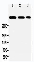 Anti-Laminin 2 alpha antibody, PA2160, Western blotting
Lane 1: HELA Cell Lysate
Lane 2: A549 Cell Lysate
Lane 3: PANC Cell Lysate