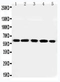 Anti-RGS14 antibody, PA2163, Western blotting
Lane 1: Rat Thymus Tissue Lysate
Lane 2: Rat Spleen Tissue Lysate
Lane 3: RAJI Cell Lysate
Lane 4: CEM Cell Lysate
Lane 5: JURKAT Cell Lysate