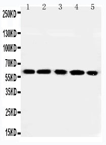 Anti-RGS14 antibody, PA2163, Western blotting
Lane 1: Rat Thymus Tissue Lysate
Lane 2: Rat Spleen Tissue Lysate
Lane 3: RAJI Cell Lysate
Lane 4: CEM Cell Lysate
Lane 5: JURKAT Cell Lysate