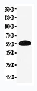Anti-EAAT3 antibody, PA2164-1, Western blotting
WB: Human Placenta Tissue Lysate