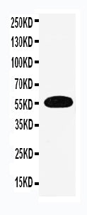 Anti-EAAT3 antibody, PA2164-1, Western blotting
WB: Human Placenta Tissue Lysate