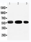 Anti-EAAT3 antibody, PA2164-2, Western blotting
Lane 1: Rat Liver Tissue Lysate
Lane 2: Rat Heart Tissue Lysate
Lane 3: HEPA Cell Lysate