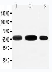 Anti-EAAT3 antibody, PA2164-2, Western blotting
Lane 1: Rat Liver Tissue Lysate
Lane 2: Rat Heart Tissue Lysate
Lane 3: HEPA Cell Lysate