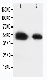 Anti-Glucose Transporter 8 antibody, PA2165, Western blotting
Lane 1: Rat Testis Tissue Lysate
Lane 2: Human Placenta Tissue Lysate