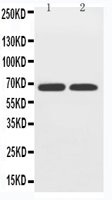 Anti-GLUT12 antibody, PA2167, Western blotting
Lane 1: PC-12 Cell Lysate
Lane 2: A549 Cell Lysate