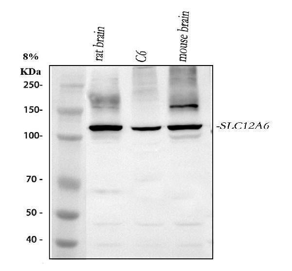Anti-SLC12A6 Antibody Picoband®