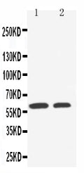 Anti-SLC22A1 antibody, PA2172, Western blotting
Lane 1: HELA Cell Lysate
Lane 2: A549 Cell Lysate
