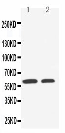 Anti-SLC22A1 antibody, PA2172, Western blotting
Lane 1: HELA Cell Lysate
Lane 2: A549 Cell Lysate