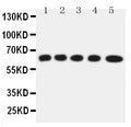 Anti-Solute carrier family 22 member 5 antibody, PA2174, Western blotting
Lane 1: Rat Kidney Tissue Lysate
Lane 2: Rat Skeletal Muscles Tissue Lysate
Lane 3: Mouse Liver Tissue Lysate
Lane 4: HEPA Cell Lysate
Lane 5: NIH3T3 Cell Lysate