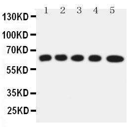 Anti-Solute carrier family 22 member 5 antibody, PA2174, Western blotting
Lane 1: Rat Kidney Tissue Lysate
Lane 2: Rat Skeletal Muscles Tissue Lysate
Lane 3: Mouse Liver Tissue Lysate
Lane 4: HEPA Cell Lysate
Lane 5: NIH3T3 Cell Lysate