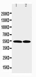 Anti-CCR3 antibody, PA2176, Western blotting
Lane 1: K562 Cell Lysate
Lane 2: RAJI Cell Lysate